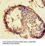 Angiotensin-Converting Enzyme 2 (ACE2) Antibody