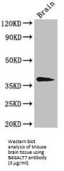 Beta-1,4-Galactosyltransferase 7 (B4GALT7) Antibody