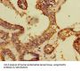 DDB1 And CUL4 Associated Factor 8 (DCAF8) Antibody