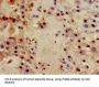 Integrin Beta 4 (ITGb4) Antibody