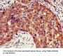 Integrin Beta 4 (ITGb4) Antibody