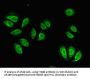 Integrin Beta 4 (ITGb4) Antibody