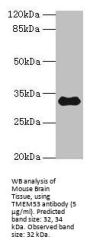 Transmembrane Protein 53 (TMEM53) Antibody