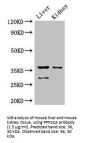 Protein Phosphatase 2 Catalytic Subunit Alpha (PPP2CA) Antibody