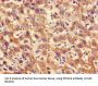 Protein Phosphatase 2 Catalytic Subunit Alpha (PPP2CA) Antibody