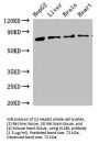 Plasma Kallikrein (KLKB1) Antibody