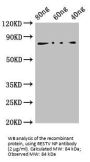 Reston Virus Nucleoprotein (RESTV NP) Antibody