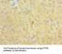 ATPase, Cu++ Transporting Beta Polypeptide (ATP7B) Antibody