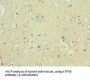 ATPase, Cu++ Transporting Beta Polypeptide (ATP7B) Antibody