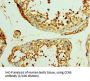 CCN Family Member 5 (CCN5) Antibody