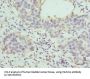 Hyaluronan And Proteoglycan Link Protein 1 (HAPLN1) Antibody