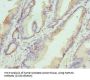Hyaluronan And Proteoglycan Link Protein 1 (HAPLN1) Antibody