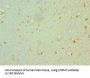 Muscarinic Acetylcholine Receptor M3 (CHRM3) Antibody