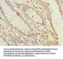 Serine/threonine-Protein Phosphatase 2A 56 kDa Regulatory Subunit Gamma Isoform (PPP2R5C) Antibody