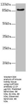 SPT20 Homolog, SAGA Complex Component (SUPT20H) Antibody