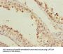 SPT20 Homolog, SAGA Complex Component (SUPT20H) Antibody