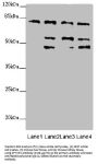 Zinc Finger FYVE Domain-Containing Protein 1 (ZFYVE1) Antibody