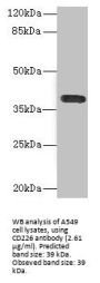 Cluster of Differentiation 226 (CD226) Antibody