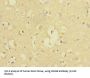 Cluster of Differentiation 226 (CD226) Antibody