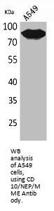 Neprilysin / NEP (MME) Antibody