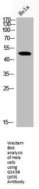 Glycogen Synthase Kinase 3 Beta Phospho-Ser9 (GSK3B pS9) Antibody