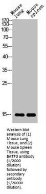 Basic Leucine Zipper ATF-Like Transcription Factor 3 (BATF3) Antibody