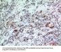 Basic Leucine Zipper ATF-Like Transcription Factor 3 (BATF3) Antibody