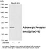 Adrenoceptor Beta 2 Phospho-Ser346 (ADRB2 pS346) Antibody