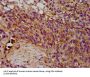 Eosinophil Peroxidase (EPX) Antibody