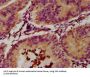 Eosinophil Peroxidase (EPX) Antibody