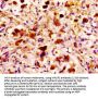 Mannose Associated Serine Protease 2 (MASP2) Antibody