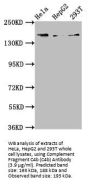 Complement Fragment C4b (C4b) Antibody