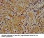 Complement Fragment C4b (C4b) Antibody