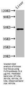 Alpha-(1,6)-Fucosyltransferase (FUT8) Antibody