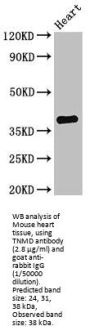 Tenomodulin (TNMD) Antibody