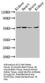 NADH Ubiquinone Oxidoreductase Core Subunit S2 (NDUFS2) Antibody