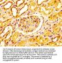 NADH Ubiquinone Oxidoreductase Core Subunit S2 (NDUFS2) Antibody