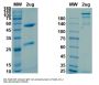 SARS-CoV-2 Spike Glycoprotein Antibody