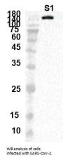 SARS-CoV-2 Spike Glycoprotein Antibody
