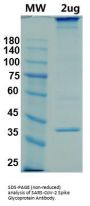 SARS-CoV-2 Spike Glycoprotein Antibody