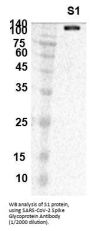 SARS-CoV-2 Spike Glycoprotein Antibody