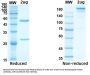 SARS-CoV-2 Nucleocapsid Protein Antibody