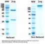 SARS-CoV-2 Spike Protein NTD Antibody