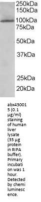 Serine/threonine-Protein Kinase TAO3 (TAOK3) Antibody