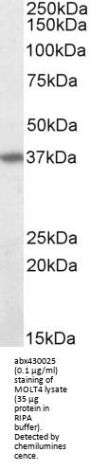 TNF Receptor Superfamily Member 6 / CD95 / TNFRSF6 (FAS) Antibody