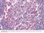 TNF Receptor Superfamily Member 6 / CD95 / TNFRSF6 (FAS) Antibody