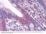 TNF Receptor Superfamily Member 6 / CD95 / TNFRSF6 (FAS) Antibody