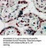 Chromobox Protein Homolog 1 (CBX1) Antibody