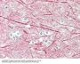 Neurofilament Medium Polypeptide (NEFM) Antibody