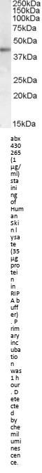 Adrenocorticotropic Hormone Receptor (MC2R) Antibody